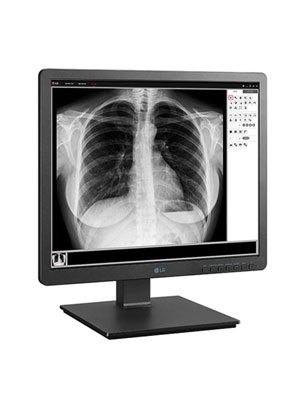 19 (48.26cm) 1.3 MP Clinical Review Monitor 1280 x 1024